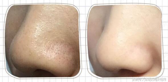 撕拉面膜脸部毛孔深层清洁测评,撕拉去黑头收缩毛孔祛痘印面膜