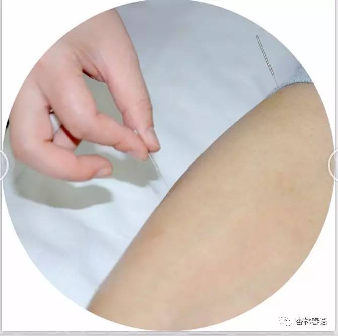 「中医养生保健素养常识」经穴养生之针刺\熏洗\耳压\刮痧