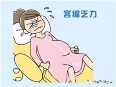 分娩前的问题,分娩必须知道的五件事