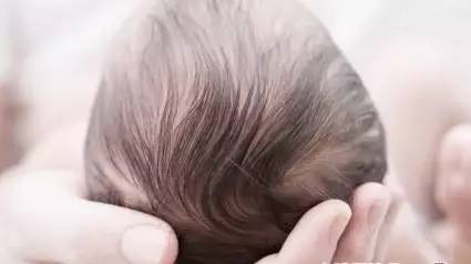 六个月宝宝头皮乳痂可以抠吗,宝宝乳痂不能抠会有灾难性后果