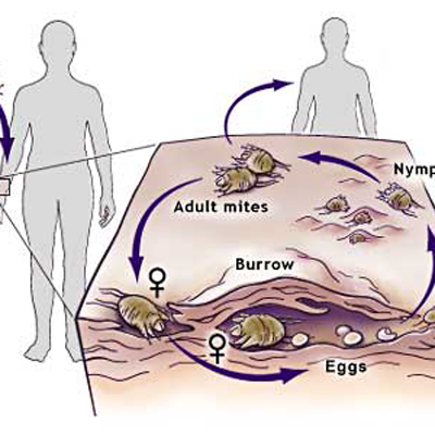 实用皮肤病验方精选,所有治疗皮肤病的药理良方