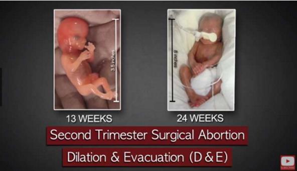 堕胎手术详细流程,女性堕胎手术的可怕真相