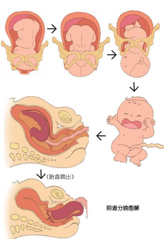 怎样缩短产程减轻宫缩痛,分娩减轻疼痛的方法