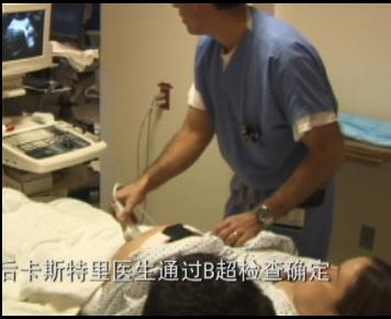 孕妇剖腹生下双胞胎惊呆医生,双胞胎出生过程实录