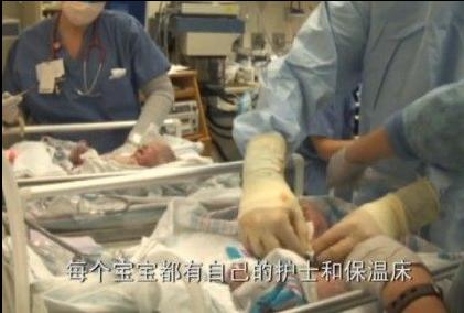 孕妇剖腹生下双胞胎惊呆医生,双胞胎出生过程实录