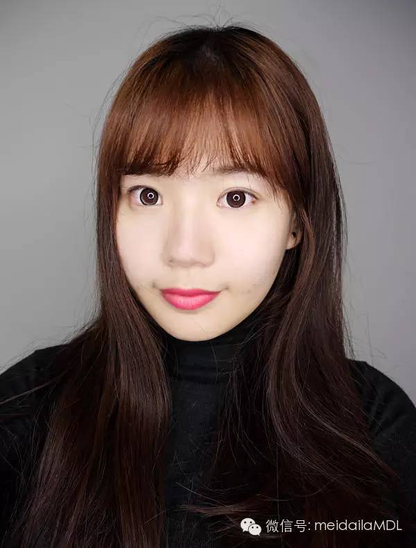 填充法令纹用什么牌子玻尿酸最好,法令纹填充胶原蛋白还是玻尿酸好