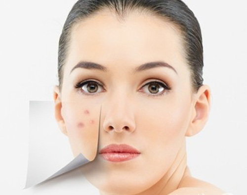 这段时间一直长痘痘是什么原因,长了很严重的痘痘去哪里看比较好