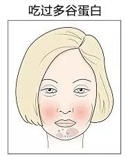 肤色不均痘印暗沉黑眼圈,长痘有法令纹真的会让人自卑