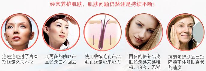 肤色不均痘印暗沉黑眼圈,长痘有法令纹真的会让人自卑