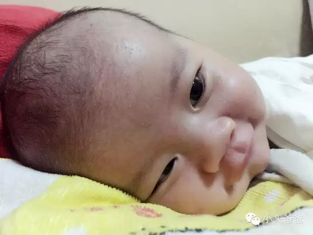 婴儿湿疹皮肤科普讲堂,小婴儿皮肤湿疹怎么办