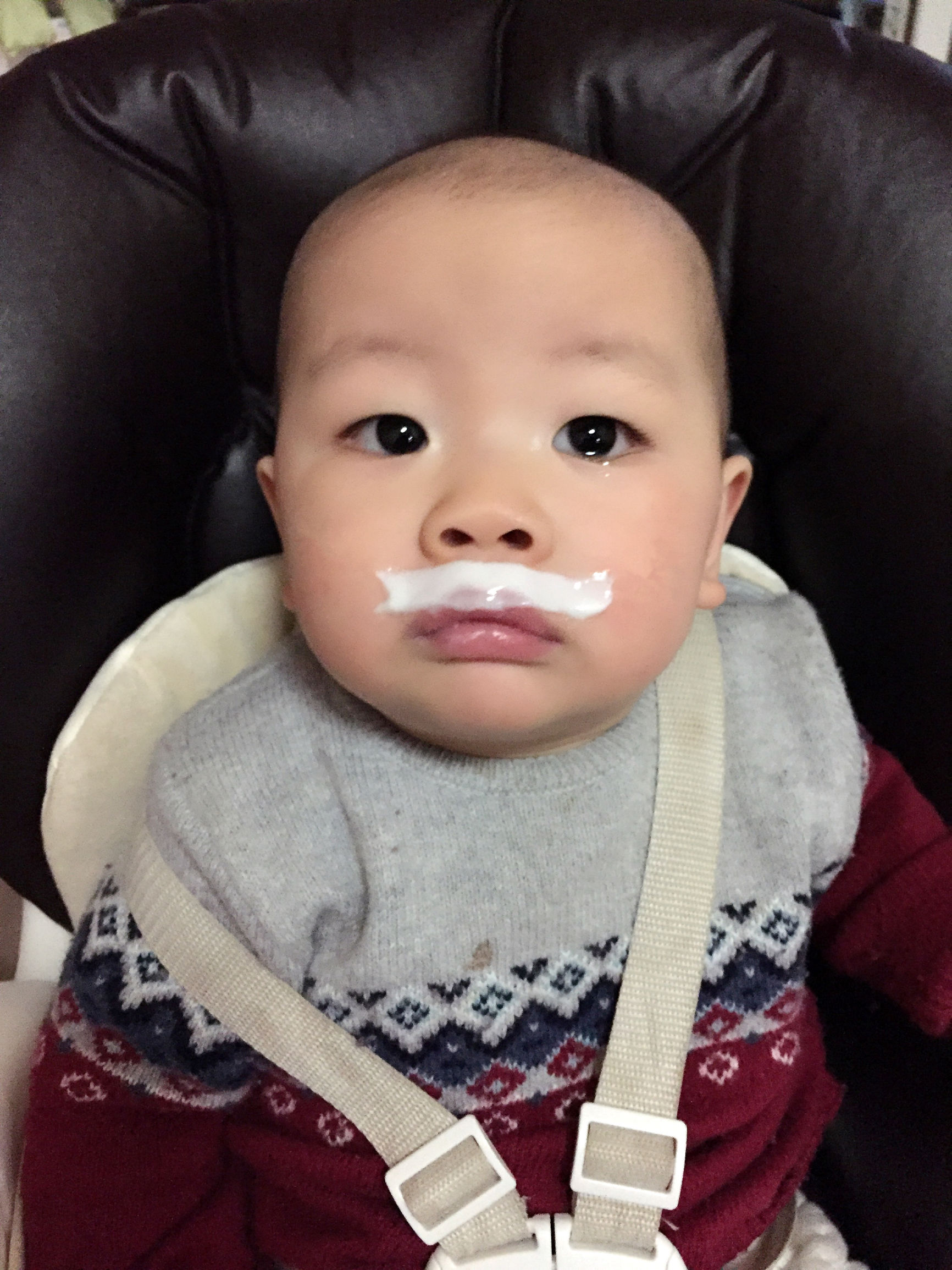 婴儿湿疹皮肤科普讲堂,小婴儿皮肤湿疹怎么办