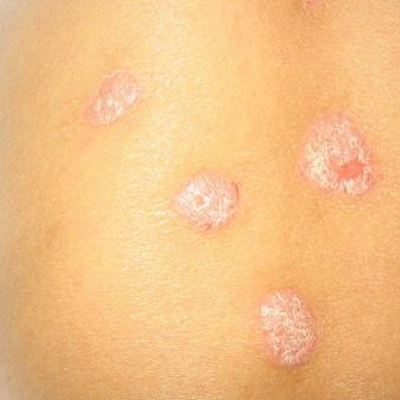 实用皮肤病验方精选,所有治疗皮肤病的药理良方