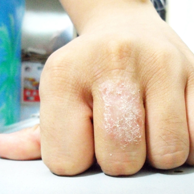 实用皮肤病验方精选,所有治疗皮肤病的药理良方