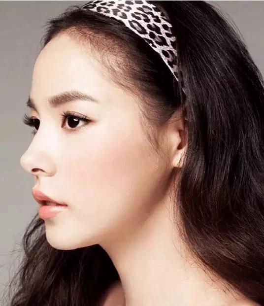 鼻子垫的太往上了,鼻子垫得不高是不是不容易歪