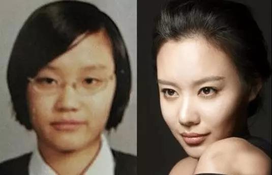 鼻子垫的太往上了,鼻子垫得不高是不是不容易歪