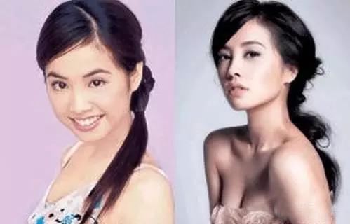 鼻子垫的太往上了,鼻子垫得不高是不是不容易歪