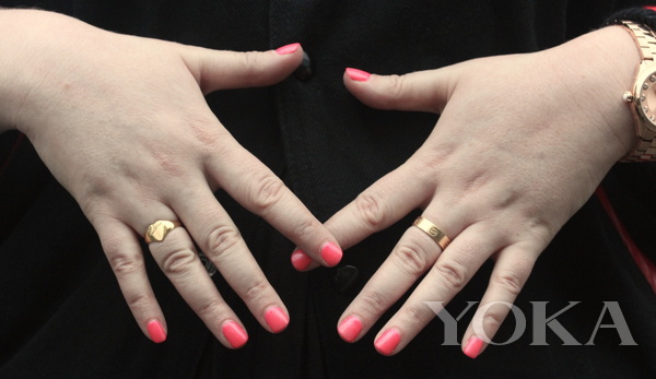 吸睛进阶术:拯救“不完美手”大作战戒指有话要说