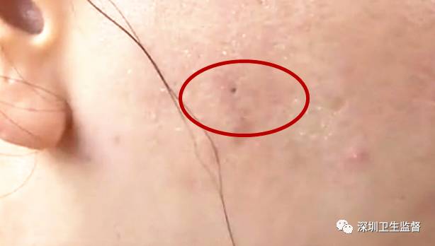 “我跟你说美女，打了这个保证瘦的！”结果……