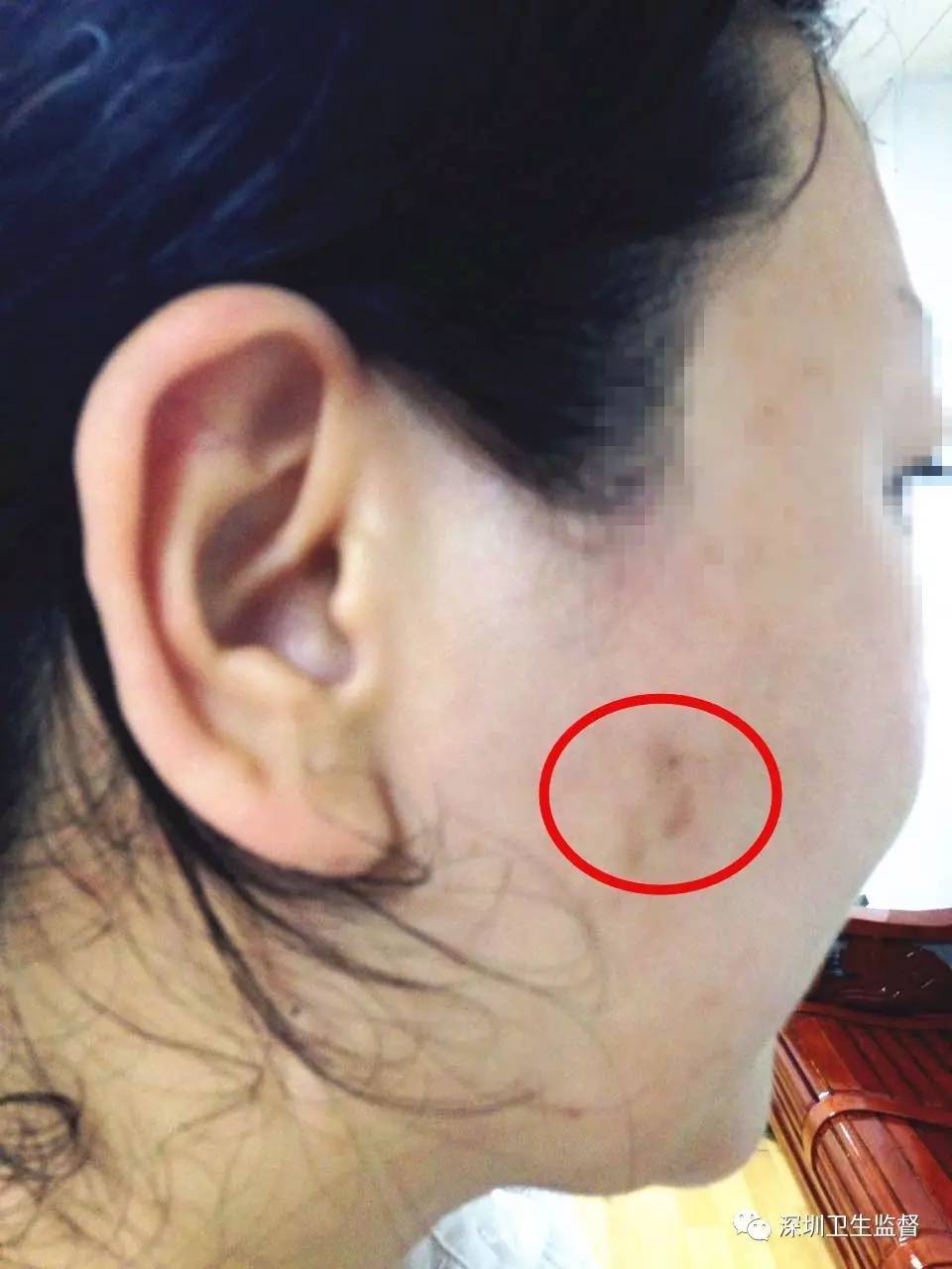 “我跟你说美女，打了这个保证瘦的！”结果……