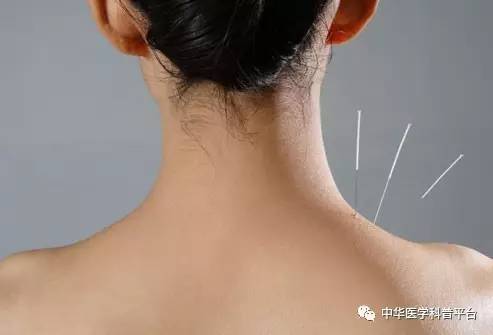 中医治疗紧张性头痛的方法,怎么缓解紧张头痛