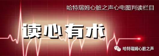 左束支阻滞会引起心梗吗,急性前间壁心肌梗死怎么治疗