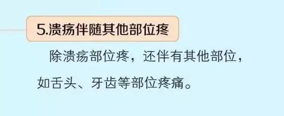 医院都不说口腔溃疡最快解决方法,三分钟让你了解口腔溃疡全部真相