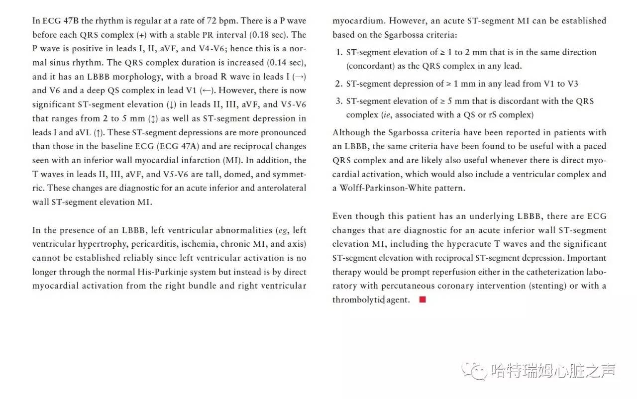 左束支阻滞会引起心梗吗,急性前间壁心肌梗死怎么治疗