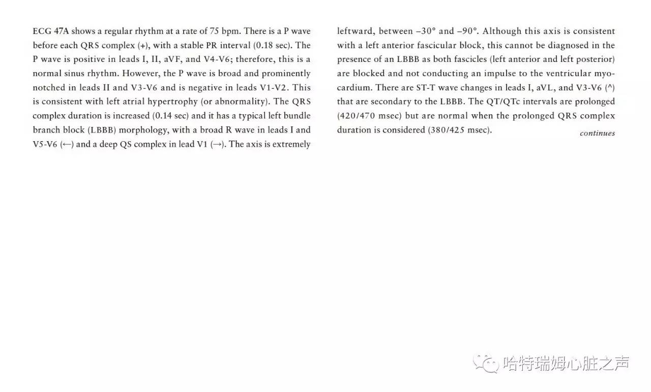 左束支阻滞会引起心梗吗,急性前间壁心肌梗死怎么治疗