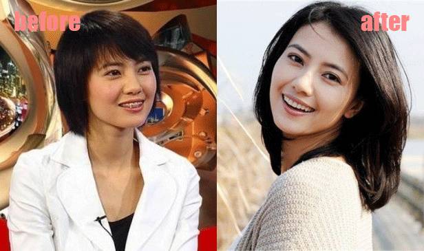 整牙变美第一步,整牙变脸