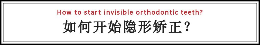 整牙变美第一步,整牙变脸