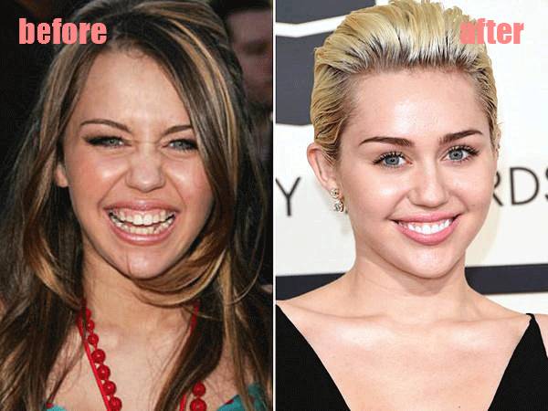 整牙变美第一步,整牙变脸