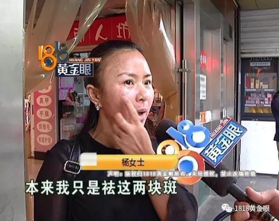 浙江女子用了姐妹推荐的美容产品觉得脸被毁老公要离婚