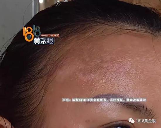 浙江女子用了姐妹推荐的美容产品觉得脸被毁老公要离婚