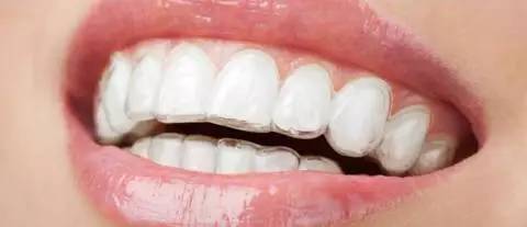 整牙变美第一步,整牙变脸