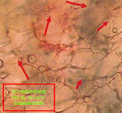 服用中药半夏要忌什么,半夏中药的功效与作用