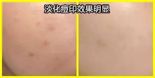 妆前三分钟快速补水面膜,搞定早晚护肤的涂抹面膜