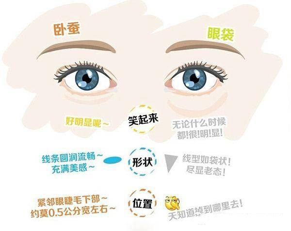 卧蚕眼袋黑眼圈傻傻分不清楚,卧蚕和眼袋的区别图片对比