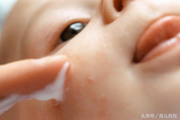 孩子过敏起疙瘩怎么办,小孩过敏起疙瘩了怎么办