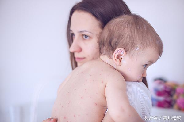 孩子过敏起疙瘩怎么办,小孩过敏起疙瘩了怎么办