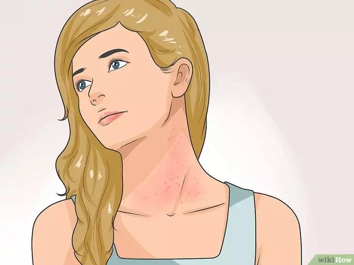 如何判断咽喉炎是不是细菌性感染,抗链球菌高引起的咽喉炎怎么治疗