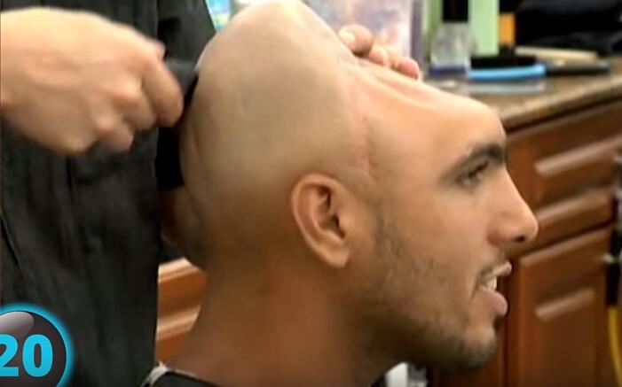 他们才是真正的超人，再大的挫折都挫不到他们，头不全又怎样