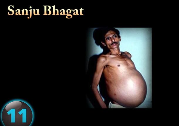 他们才是真正的超人，再大的挫折都挫不到他们，头不全又怎样