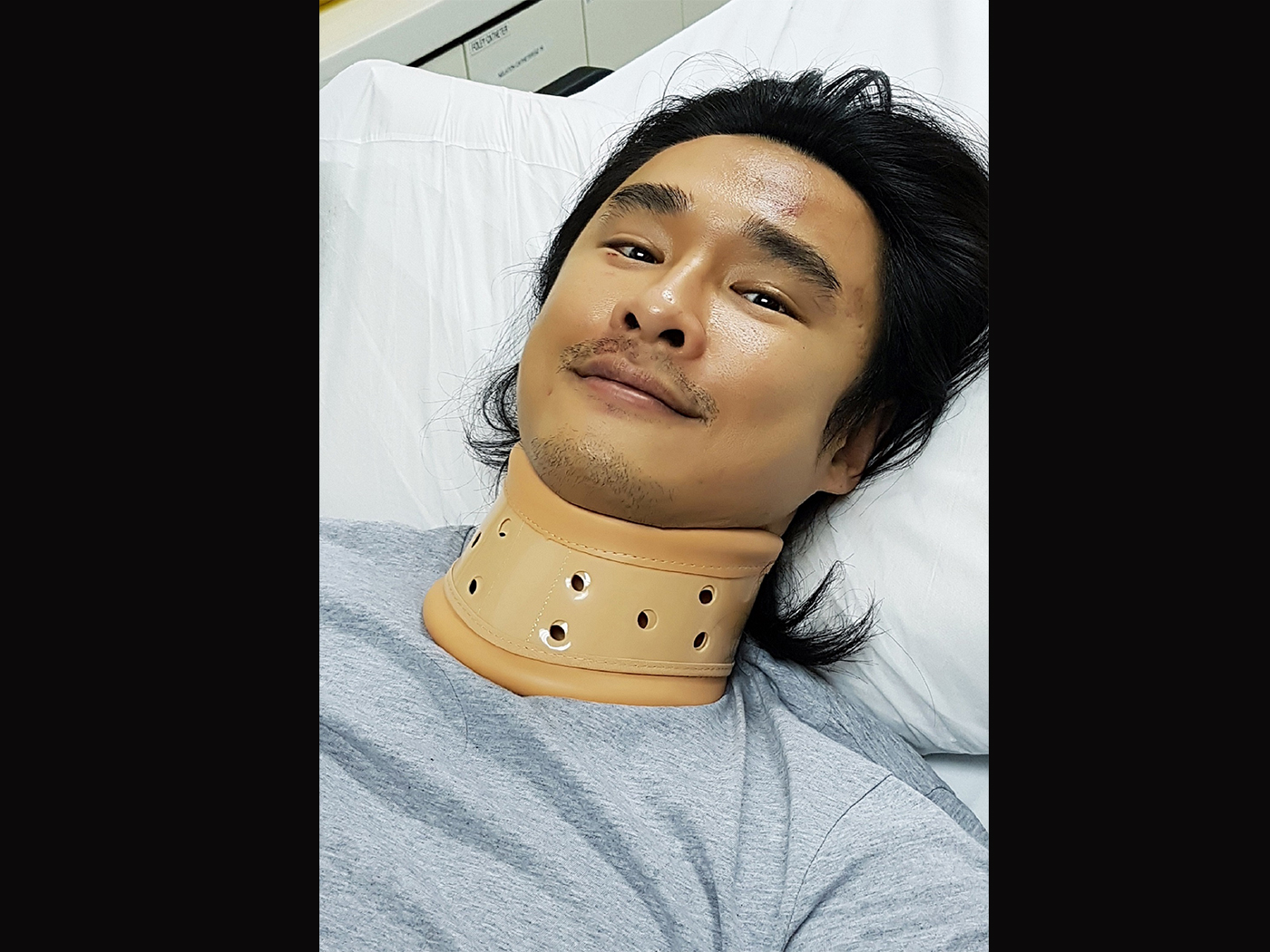 前艺人遇洋路霸称被打脑淤血