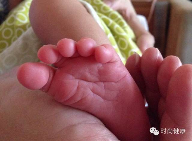 禧妈胡可的月子日记Day15：宝宝红PP怎么办？