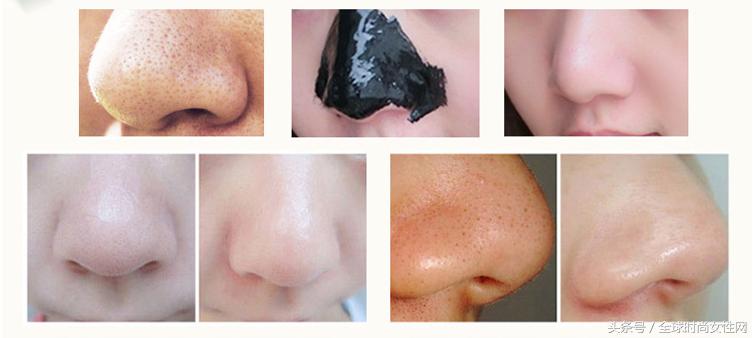 撕拉面膜脸部毛孔深层清洁测评,撕拉去黑头收缩毛孔祛痘印面膜