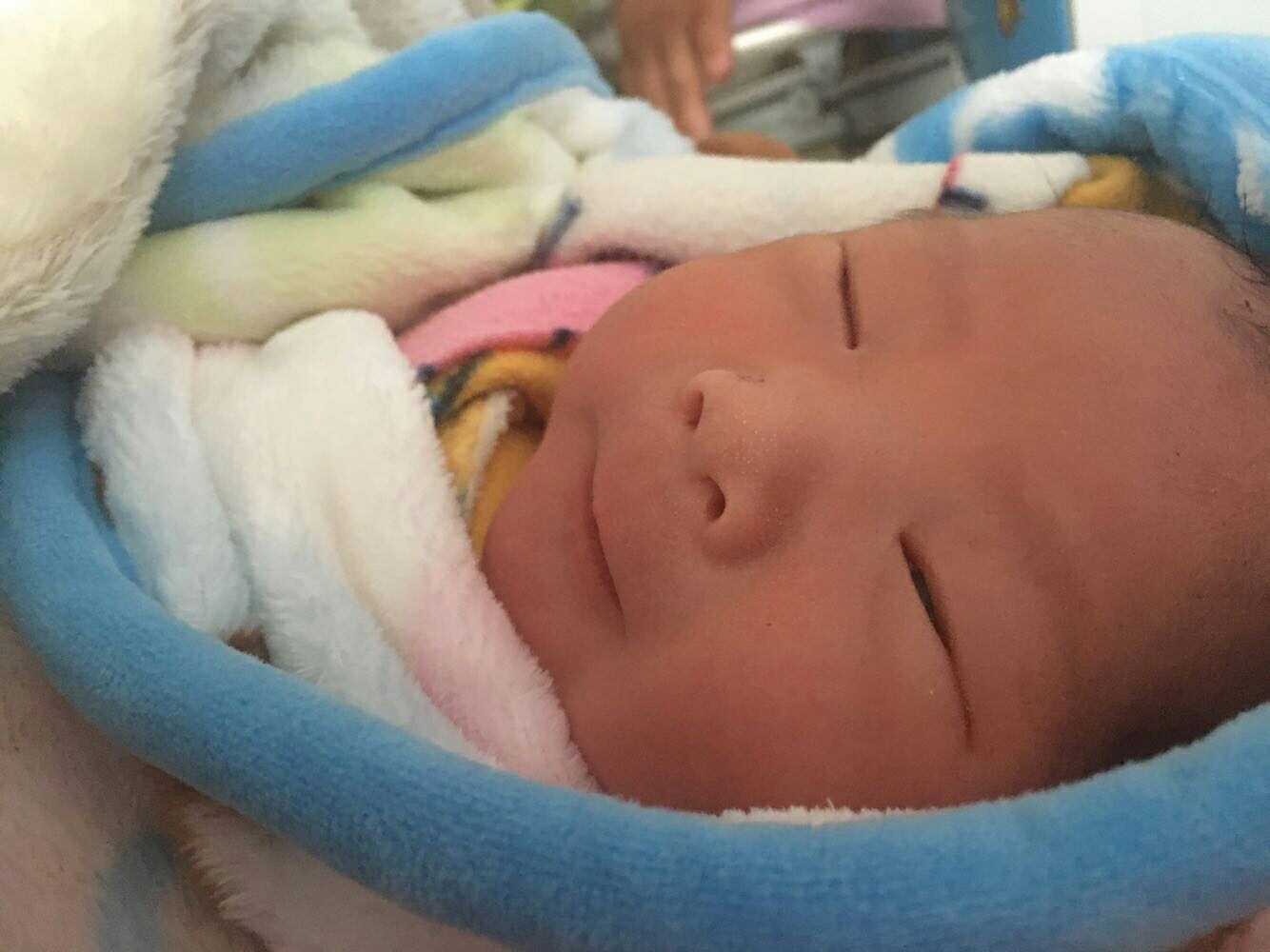 剖腹产的时候宝宝胎动怎么办,胎动频繁剖腹产