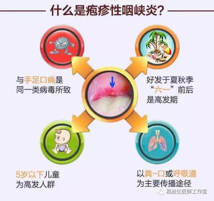 亮剑“疱疹性咽峡炎”,中医中药显良效!