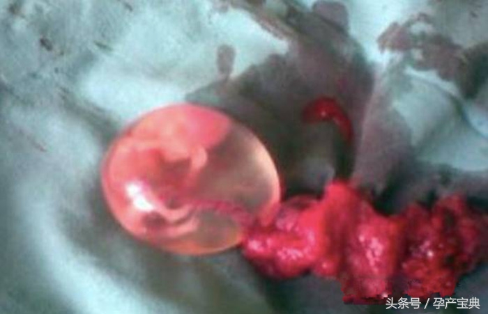 孕期什么症状都没有正常吗,孕期什么症状不能要孩子