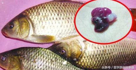 24岁小伙海鲜中毒抢救后续,生吞鱼胆中毒抢救后脱险