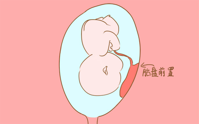 胎盘前壁和后壁哪个对宫颈好,胎盘前壁和后壁哪个更适合顺产